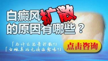 心理压力大会长白癜风吗