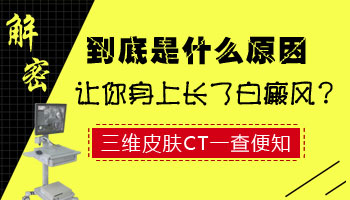 腿部膝盖周围白斑扩散的原因是什么