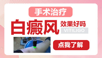 孙女会不会遗传奶奶的白癜风