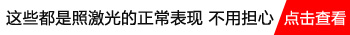 白癜风是不是照完发红的症状退去才可以再照