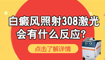 照激光以后有白斑的地方会痒痒吗