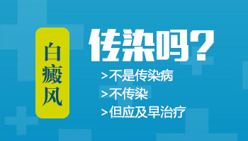 白斑病的患者可以在食品厂里上班吗