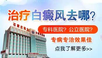 额头上有块白色的皮肤要看什么科
