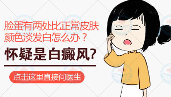 小孩脸上长白斑