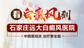 孩子眼皮白癜风治疗6年后复发了要怎么治疗