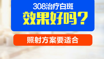 孩子胳膊上一块白斑照激光能照好吗