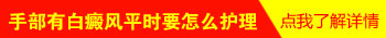 孩子手部白癜风有3个月了怎么治疗