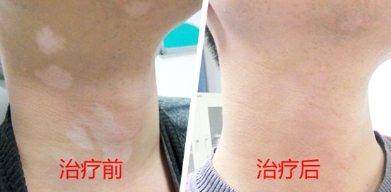 感恩教师节—远大白癜风医院与所有教师一起共抗白魔