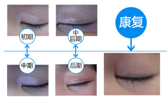 青少年儿童白斑特别关爱行动