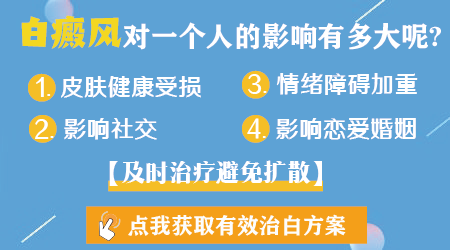 白癜风长在手上脚上严重吗