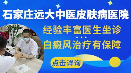 石家庄远大中医皮肤病医院哪个医生看白癜风好