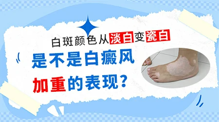 伍德灯结果显示白斑呈瓷白色是不是很难治