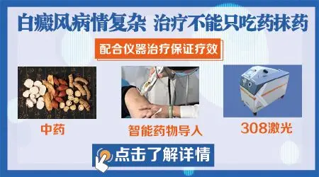 白癜风光抹外用药管用吗