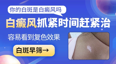 身上突然出现多处白斑怎么回事