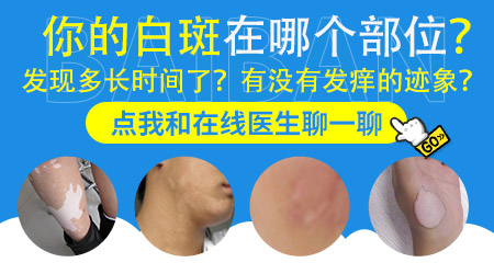 大腿根有白点是怎么回事