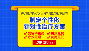 发现脸部白癜风怎么治疗