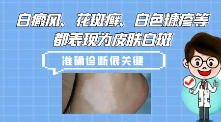 皮肤一小块白斑是什么原因造成的