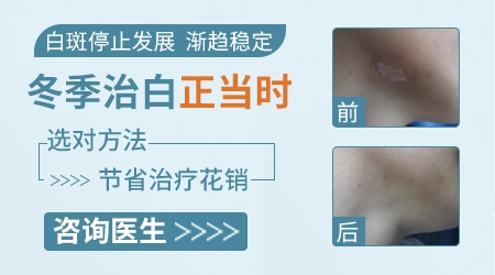 白斑边缘有色素加深正常吗