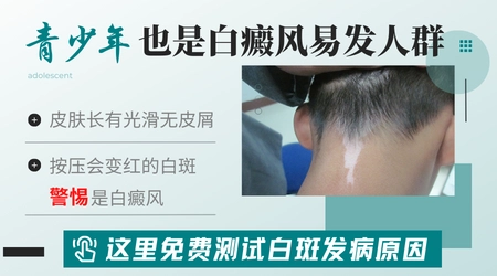 14岁女孩额头长白斑是怎么回事