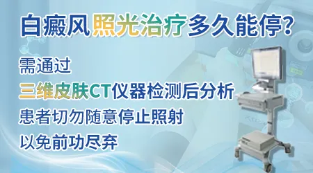 白癜风光疗长照到多少次无效就该停