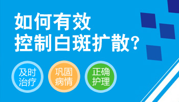 怎么样控制白斑不扩散