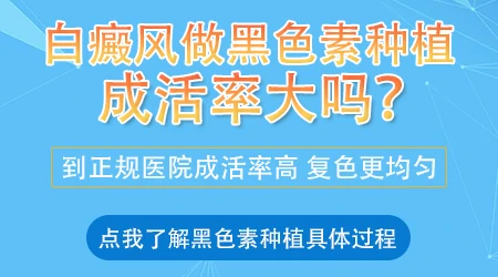 黑色素种植治疗白癜风效果好吗