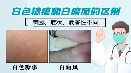 白癜风和普通白色糠疹怎么区别