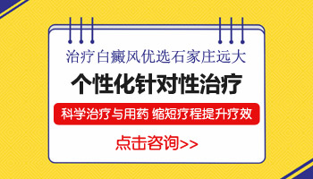 衡水白癜风医院治疗费用高不高