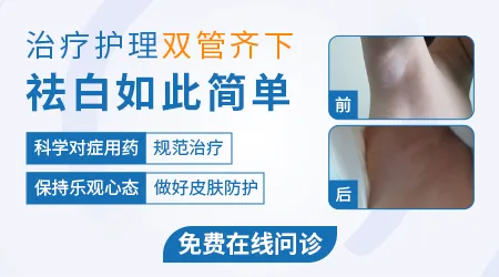 白癜风用药后白斑发红发痒是正常反应吗