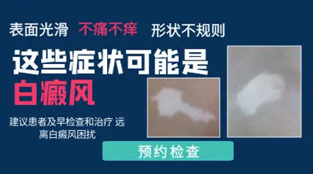 白斑摸着光滑边界清晰有可能是哪种皮肤病