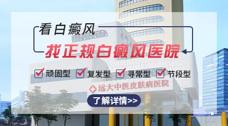石家庄远大中医皮肤病医院看白斑好吗