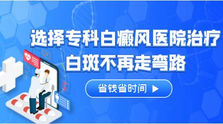 脸上有晕痣型白癜风该怎么治疗