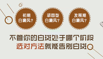 衡水白癜风发展期有什么症状表现