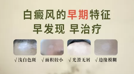 女性白斑早期症状图