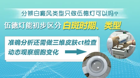 做白癜风手术去石家庄哪家医院好