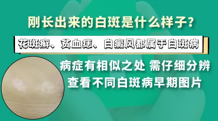 皮肤变白有可能是什么病怎么区分