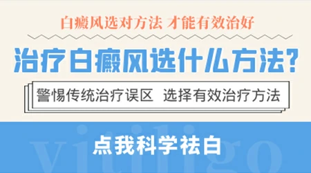 白癜风除了吃药照光还有没有别的好方法