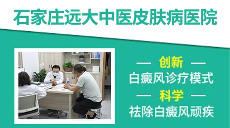 伍德灯显示小孩白癜风会不会误诊