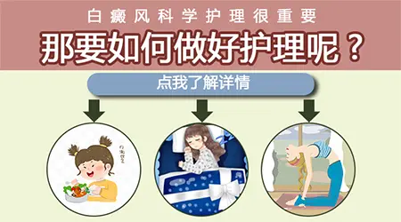 白癜风患者如何避免复发