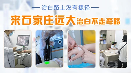 嘴唇周围出现白斑要特别注意什么