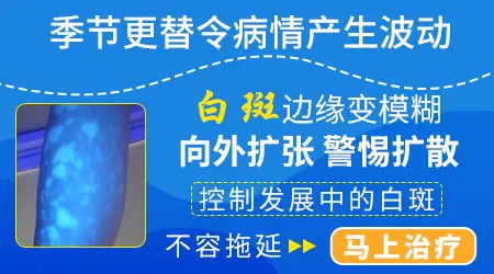 白癜风冬天变淡夏天明显是什么原因