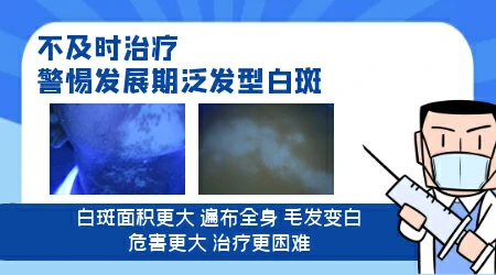 石家庄治疗白斑排名靠前的医院