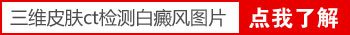 衡水白癜风医院 白斑做加号减号是什么意思