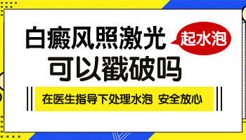 激光308照白癜风起水泡了会留疤吗