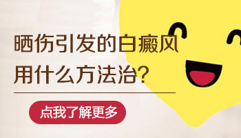 日晒引起的白癜风怎么治疗