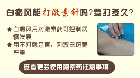 白癜风只吃激素药就可以了吗