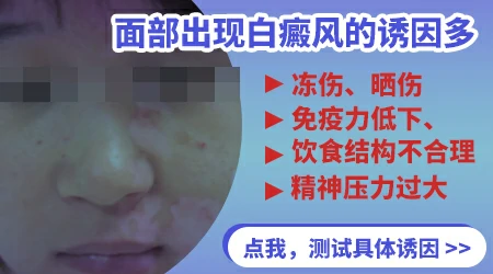 脸上突然有一块特别白怎么回事