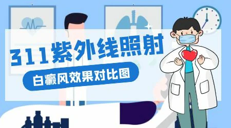 紫外线灯照射白癜风效果对比