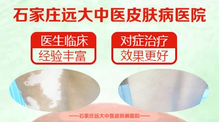 背上长白色的点点是怎么回事