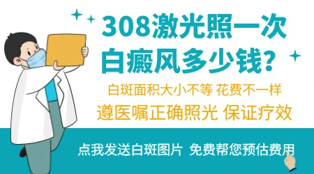 皮肤白斑照308激光一次要多少钱